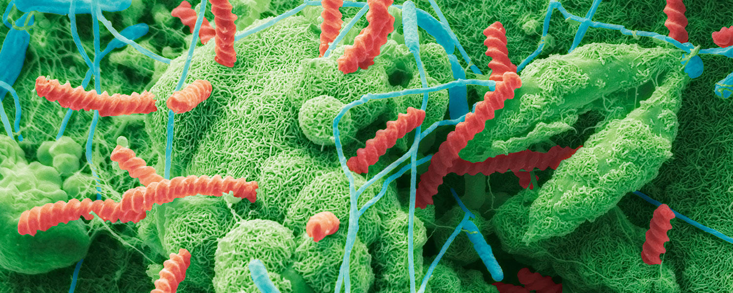 Spriochaetes bacteria that can cause water-borne disease